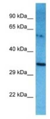 Western Blot: TXNDC6 Antibody [NBP3-09902]