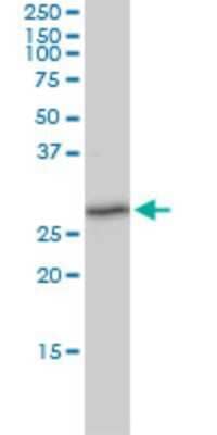 Western Blot: TXNDC9 Antibody (1E8-7C12) [H00010190-M02]