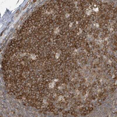 Immunohistochemistry-Paraffin: TXNDC9 Antibody [NBP1-89051]