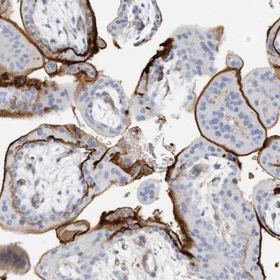 Immunohistochemistry-Paraffin: TXNDC9 Antibody [NBP1-89053]