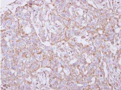 Immunohistochemistry-Paraffin: TXNDC9 Antibody [NBP2-20765]