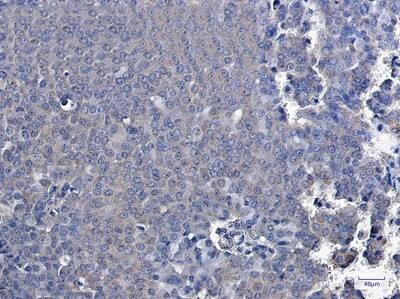 Immunohistochemistry-Paraffin: TXNDC9 Antibody (S04-4H8) [NBP3-19796]