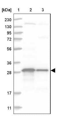 Western Blot: TXNDC9 Antibody [NBP1-89051]