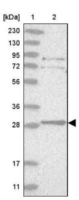 Western Blot: TXNDC9 Antibody [NBP1-89052]
