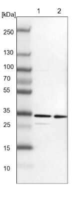 Western Blot: TXNDC9 Antibody [NBP1-89052]