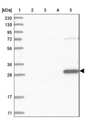 Western Blot: TXNDC9 Antibody [NBP1-89053]