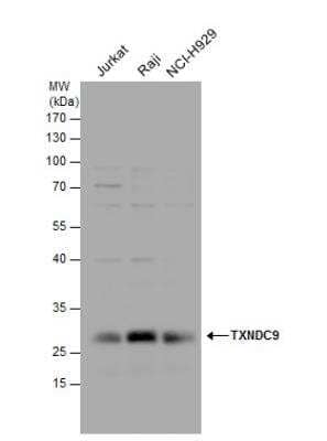 Western Blot: TXNDC9 Antibody [NBP2-20765]