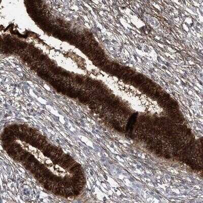 Immunohistochemistry-Paraffin: TXNIP Antibody [NBP1-84784]