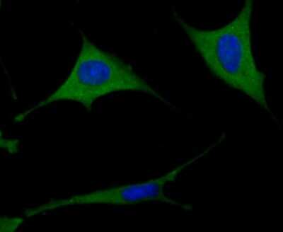 Immunocytochemistry/ Immunofluorescence: TXNIP Antibody (JM60-35) [NBP2-75692]