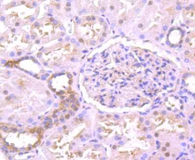 Immunohistochemistry-Paraffin: TXNIP Antibody (JM60-35) [NBP2-75692]