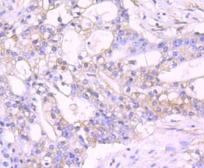 Immunohistochemistry-Paraffin: TXNIP Antibody (JM60-35) [NBP2-75692]
