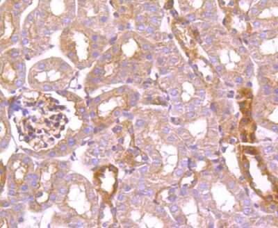 Immunohistochemistry-Paraffin: TXNIP Antibody (JM60-35) [NBP2-75692]