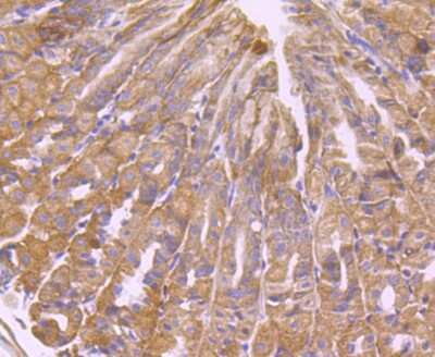 Immunohistochemistry-Paraffin: TXNIP Antibody (JM60-35) [NBP2-75692]