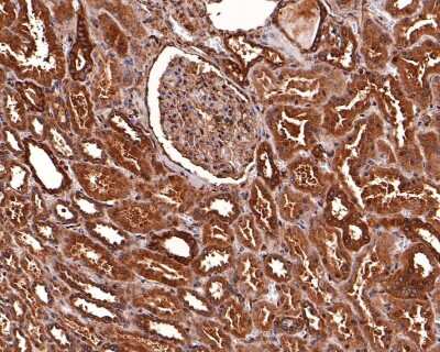 Immunohistochemistry-Paraffin: TXNIP Antibody (JM60-35) [NBP2-75692]