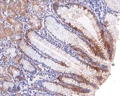 Immunohistochemistry-Paraffin: TXNIP Antibody (JM60-35) [NBP2-75692]