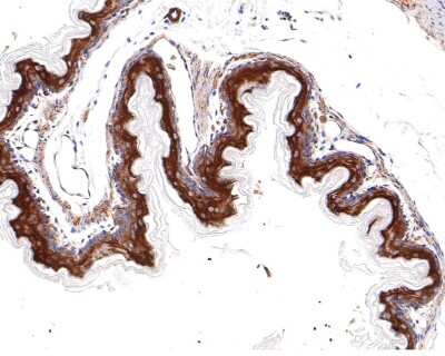 Immunohistochemistry-Paraffin: TXNIP Antibody (JM60-35) [NBP2-75692]