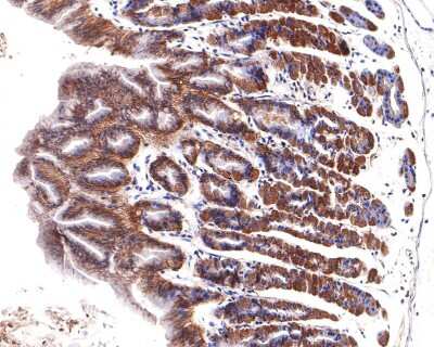 Immunohistochemistry-Paraffin: TXNIP Antibody (JM60-35) [NBP2-75692]