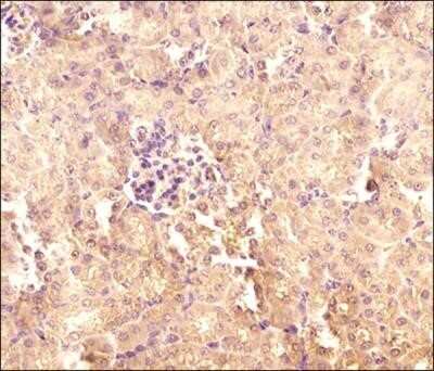 Immunocytochemistry: TXNIP Antibody (JY2) - Azide and BSA Free [NBP2-81001]