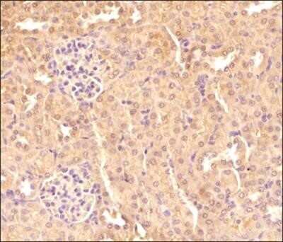 Immunohistochemistry: TXNIP Antibody (JY2) - Azide and BSA Free [NBP2-81001]
