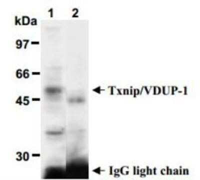Immunoprecipitation: TXNIP Antibody (JY2) - Azide and BSA Free [NBP2-81001]
