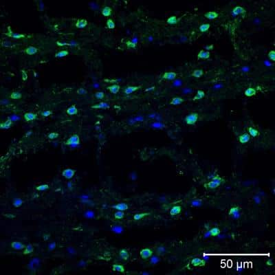 Immunohistochemistry-Frozen: TXNIP Antibody (JY2) - Azide and BSA Free [NBP1-54578]