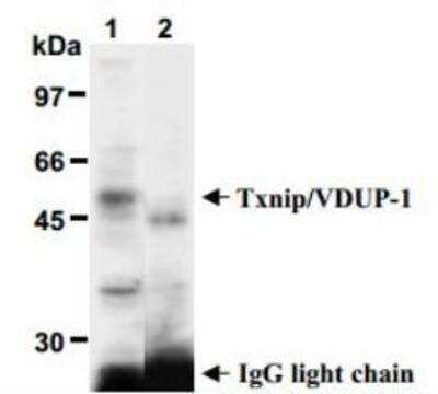 Immunoprecipitation: TXNIP Antibody (JY2) - Azide and BSA Free [NBP1-54578]