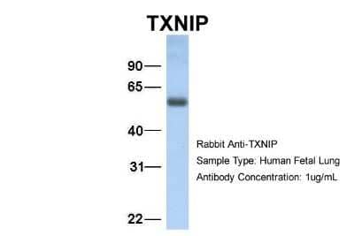 Western Blot: TXNIP Antibody [NBP1-52909]