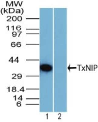 Western Blot: TXNIP Antibody [NBP2-27095]