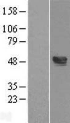 Western Blot: TXNIP Overexpression Lysate [NBL1-17474]