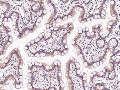 Immunohistochemistry-Paraffin: TXNL1 Antibody [NBP2-99643]
