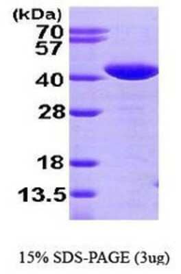 SDS-PAGE: Recombinant Human Glutaredoxin 3/GLRX3 His Protein [NBP1-44478]