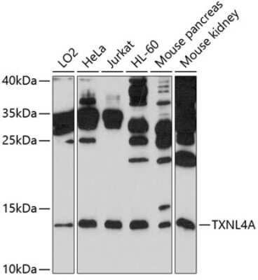 Western Blot: TXNL4A AntibodyBSA Free [NBP2-93215]