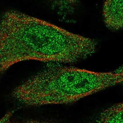 Immunocytochemistry/ Immunofluorescence: TXNL4B Antibody [NBP2-57584]