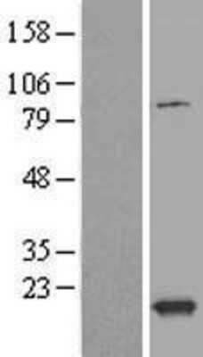 Western Blot: TXNL4B Overexpression Lysate [NBL1-17477]