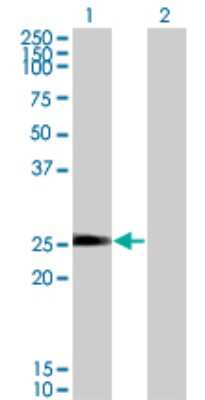 Western Blot: TXNL6 Antibody (7H3) [H00115861-M01]