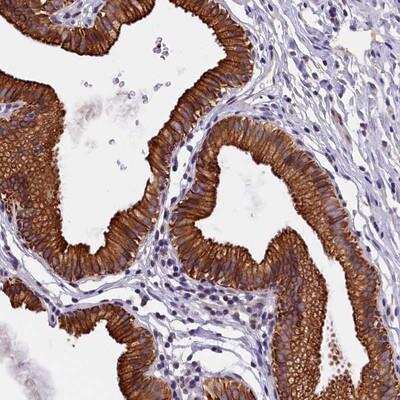 Immunohistochemistry-Paraffin: TXNL6 Antibody [NBP1-80848]