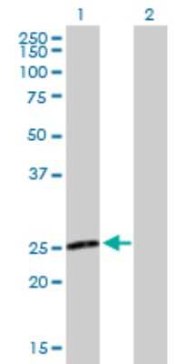 Western Blot: TXNL6 Antibody [H00115861-B01P]