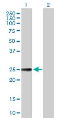 Western Blot: TXNL6 Antibody [H00115861-D01P]