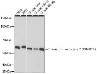 Western Blot: TXNRD2 Antibody (4O1K0) [NBP3-16715]