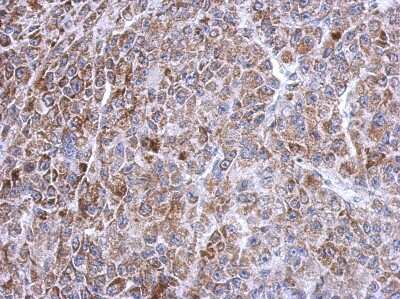 Immunohistochemistry-Paraffin: TXNRD2 Antibody [NBP2-20768]