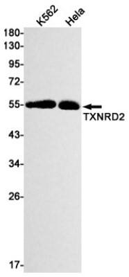 Western Blot: TXNRD2 Antibody (S02-2D6) [NBP3-19797]