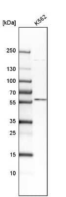 Western Blot: TXNRD2 Antibody [NBP1-86919]