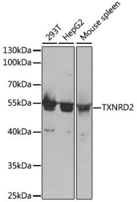 Western Blot: TXNRD2 AntibodyBSA Free [NBP2-94256]