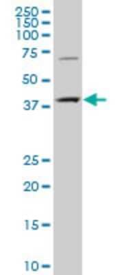 Western Blot: TYKi Antibody [H00129607-A01]