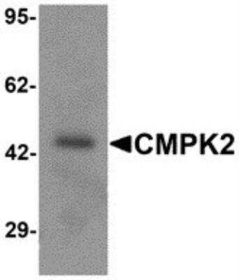 Western Blot: TYKi AntibodyBSA Free [NBP2-82045]