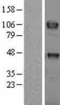 Western Blot: Dtk/TYRO3 Overexpression Lysate [NBL1-17482]