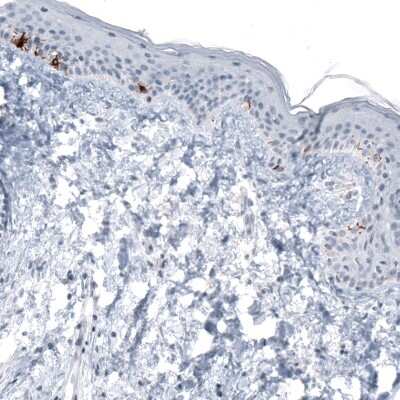 Immunohistochemistry: TYRP1 Antibody (CL4906) [NBP2-61142]