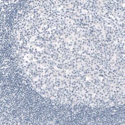 Immunohistochemistry: TYRP1 Antibody (CL4906) [NBP2-61142]