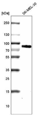 Western Blot: TYRP1 Antibody (CL4906) [NBP2-61142]