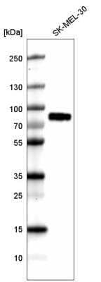 Western Blot: TYRP1 Antibody (CL4917) [NBP2-61147]